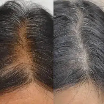 cabelo-falho.webp
