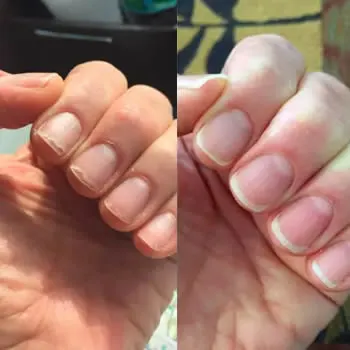 unhas.webp